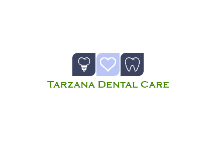 Choosing the Right Dental Crown and Costs in Tarzana